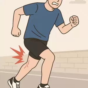 肉離れとは？原因・症状・予防法まで徹底解説！のサムネイル